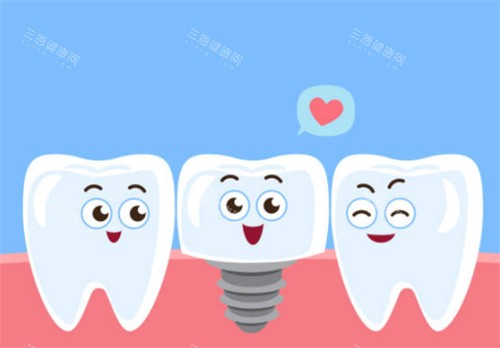 种植牙和健康的牙齿