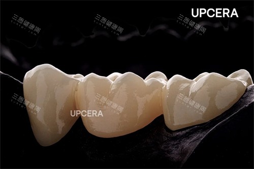 瓷倍健全瓷牙图示 瓷倍健全瓷牙图示