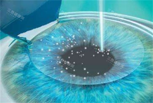 保山艾维眼科价格表大公开：全飞秒22000元起|白内障手术4800元起|斜视矫正3984元起