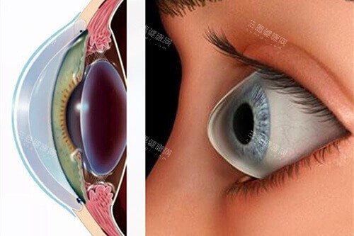 昭通艾维眼科费用透明：青少年离焦镜片899元起|角膜塑形镜7220元起|高度近视检查109元起