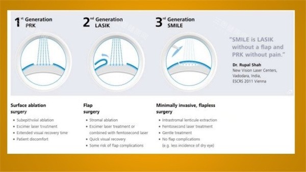 近视眼照片图 近视眼照片图