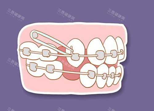 牙齿收缝卡通图片 牙齿收缝卡通图片