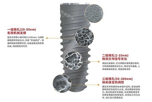 卡尔斯种植牙表面技术