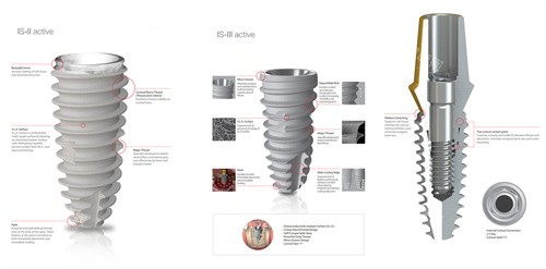 韩国纽百特种植牙植体设计