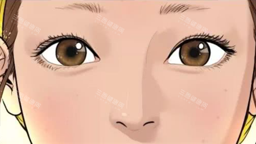 自然双眼皮 自然双眼皮