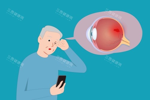 老年人白内障卡通图