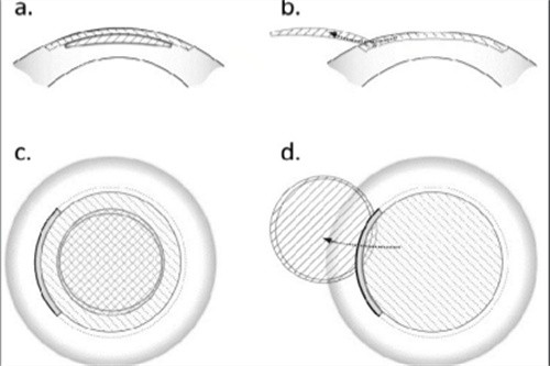 全飞秒过程 全飞秒过程