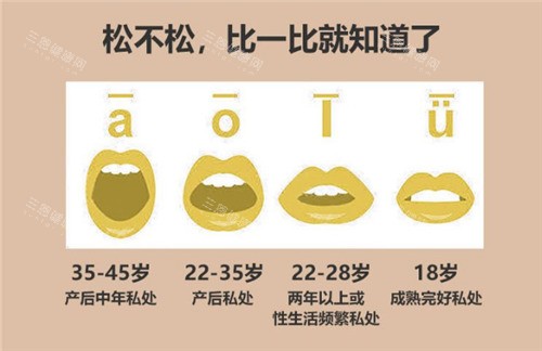 阴道松弛的程度对比 阴道松弛的程度对比