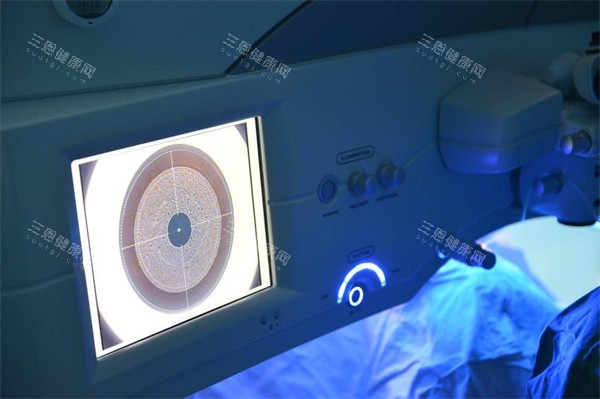 近视眼治疗图 近视眼治疗图