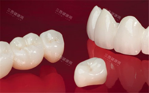 lava全瓷牙展示 lava全瓷牙展示