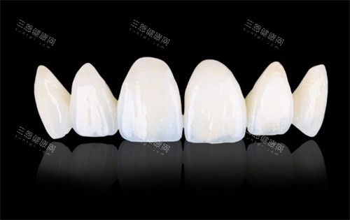 3M lava全瓷 3M lava全瓷