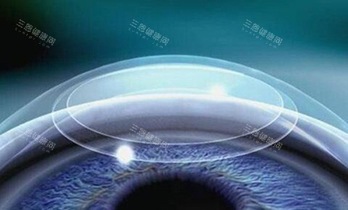 忻州爱尔眼科是正规医院吗？揭秘医院资质与实力全解析！