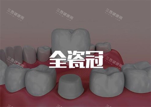 全瓷牙冠修复改善