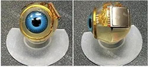 视网膜芯片植入示意图 视网膜芯片植入示意图