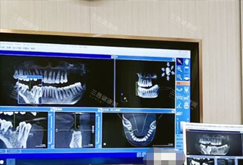 常州北极星口腔诊室拍片检查