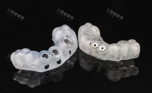 种植牙导板.webp 种植牙导板.webp