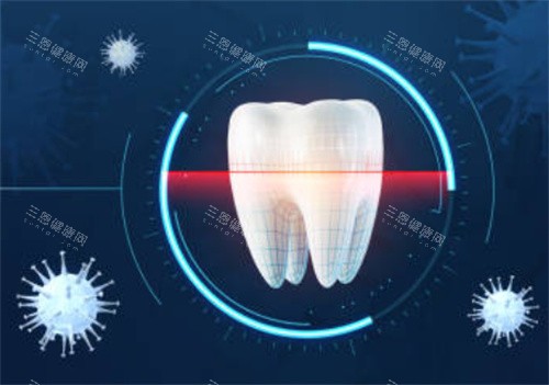 牙齿检查是否有细菌图 牙齿检查是否有细菌图