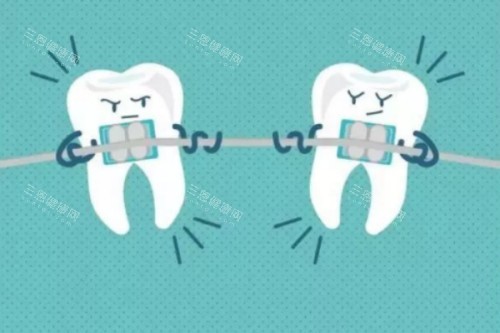 牙齿矫正卡通图 牙齿矫正卡通图