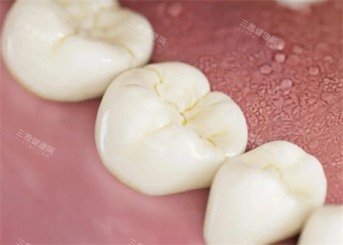 没有正确刷牙的牙齿 没有正确刷牙的牙齿