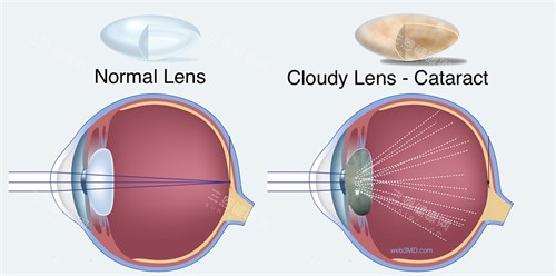 德阳市眼科医院简介_电话号码_预约挂号_收费价格表一览!揭秘德阳市眼科医院哪个医生好！