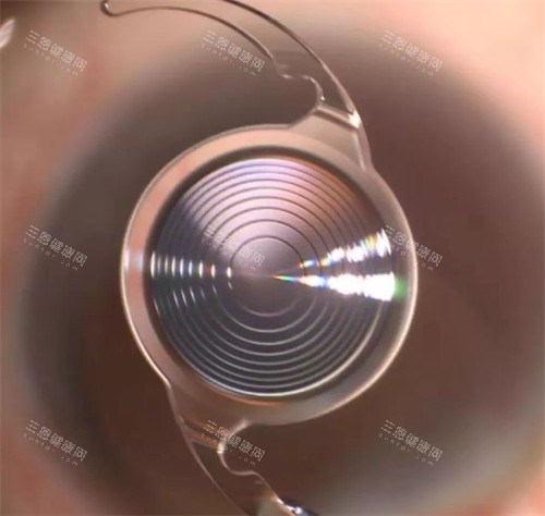 德阳市第六人民医院眼科电话号码，网上预约挂号流程，现场预约挂号流程查看！