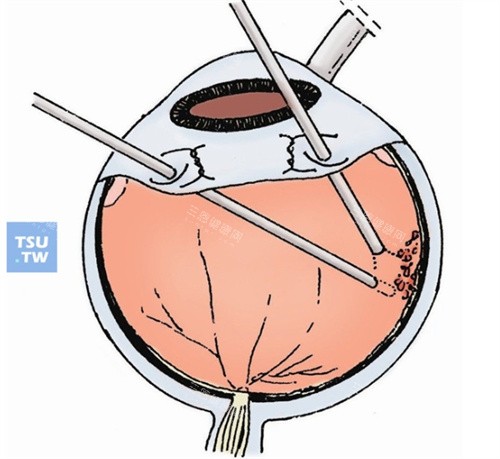 河北省眼科医院地址在哪里？邢台市襄都区泉北东大街399号是详细地址哦！