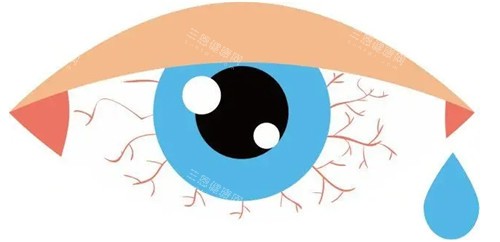 干眼症卡通图片