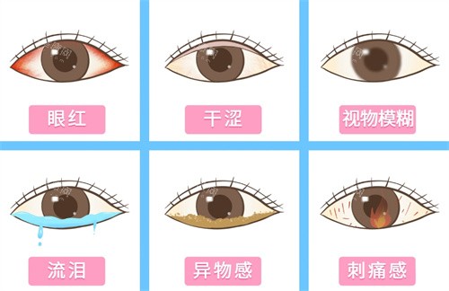 干眼症的表现