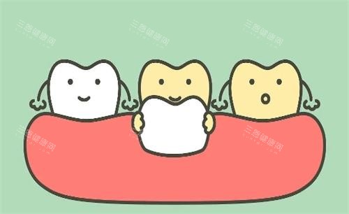 瓷贴面美白牙齿动画展示图 瓷贴面美白牙齿动画展示图